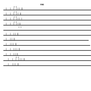 Human FAS qPCR primer set (NM_000043)